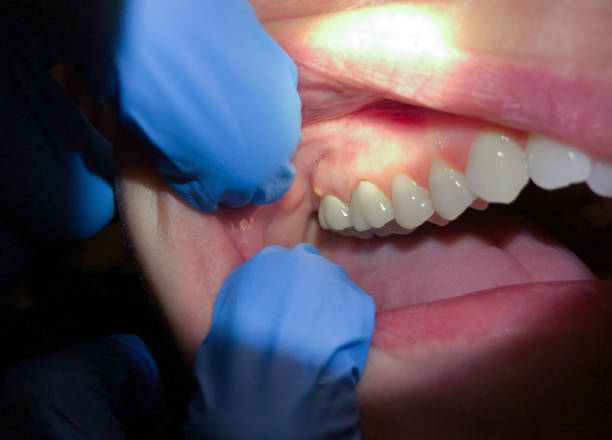 Best Emergency Denture Repair in Tecumseh, OK